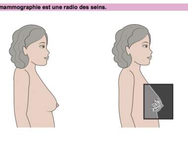 Mammographie : comment se passe l’examen, étape par étape