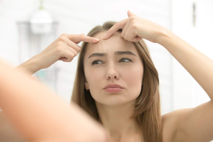 Acné : nos conseils les plus efficaces pour en venir à bout - Femme ...