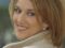 Celine Dion : sa bouche ourlée