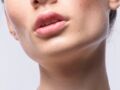 Spécial lèvres gercées
