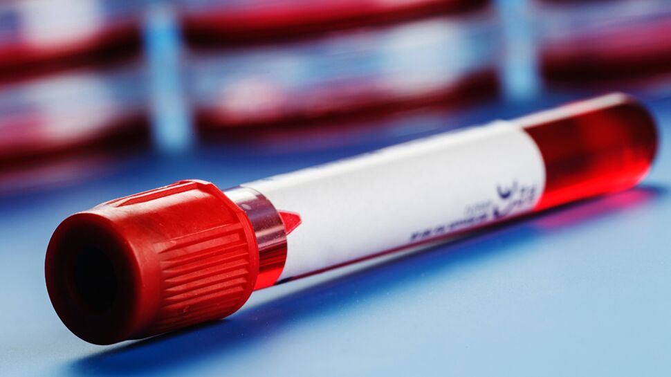 Une simple prise de sang pour détecter un cancer