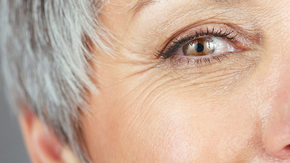 5 vérités sur la cataracte