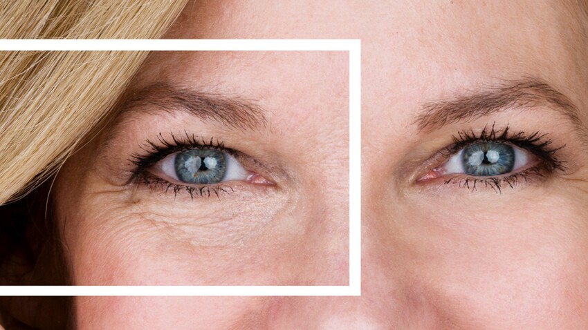 Nos Solutions Pour Eliminer Les Poches Sous Les Yeux Femme Actuelle Le Mag