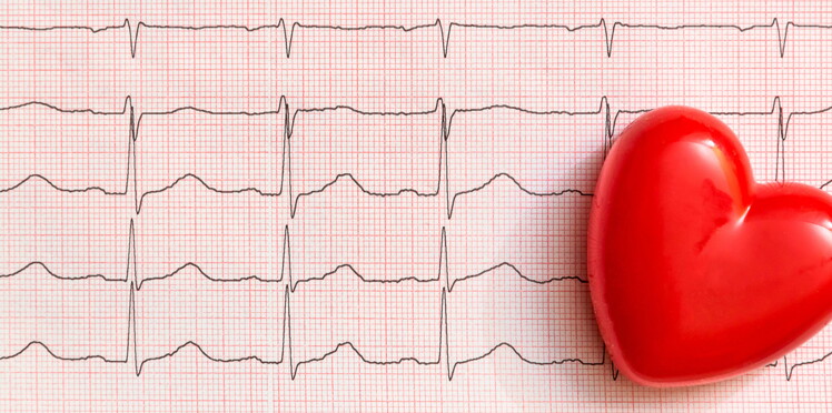 Les Troubles Du Rythme Cardiaque Affectent Aussi Le Cerveau - 