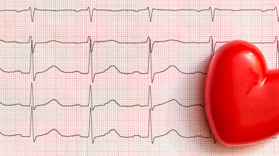 Les troubles du rythme cardiaque affectent aussi le cerveau