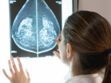 Cancer du sein : un second avis médical s'impose ?