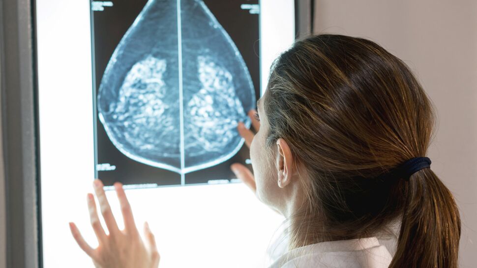 Cancer du sein : un second avis médical s'impose ?