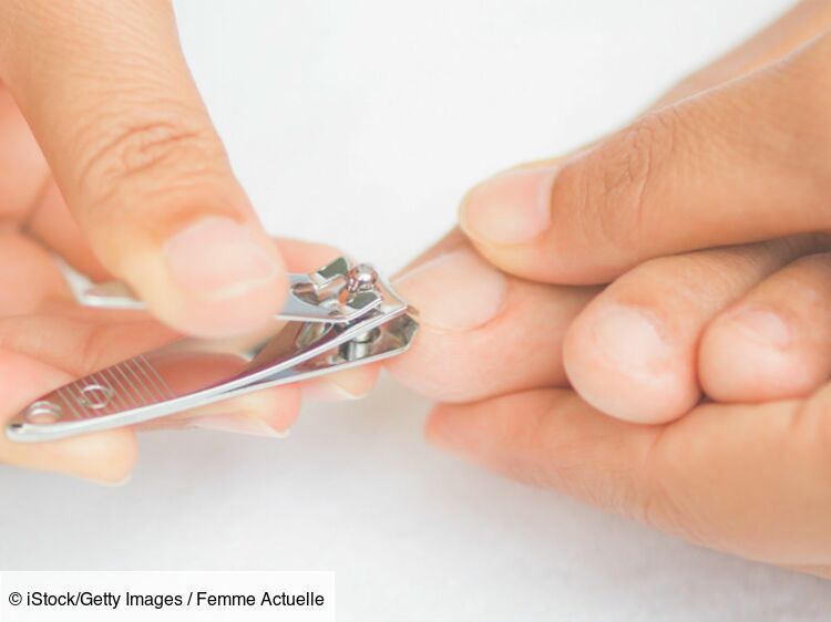 Les solutions pour soigner un ongle incarné : Femme Actuelle Le MAG