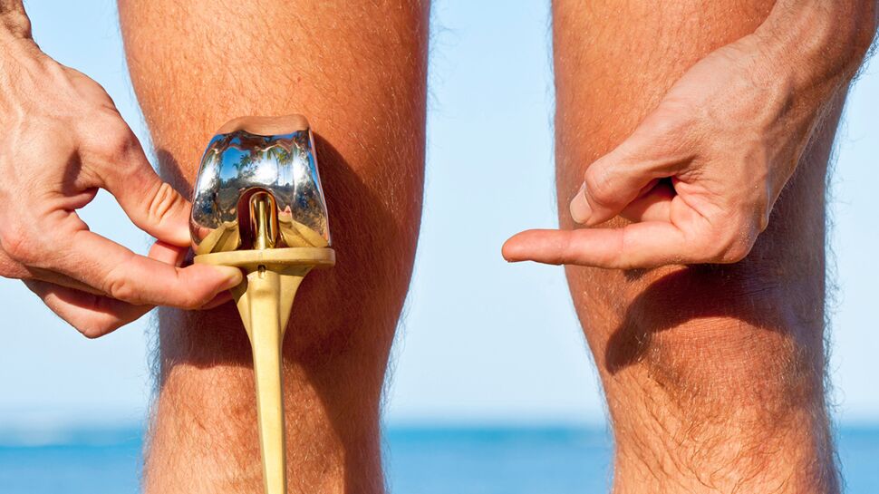 5 vérités sur la prothèse du genou