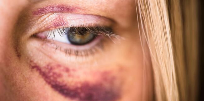1 femme sur 4 est victime de violences conjugales