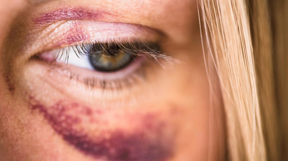 1 femme sur 4 est victime de violences conjugales