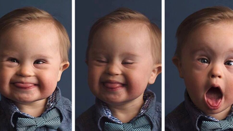 VIDEO - L’incroyable histoire de ce bébé trisomique devenu égérie d’une marque