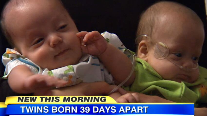 Des Jumeaux Naissent A 39 Jours D Intervalle Femme Actuelle Le Mag
