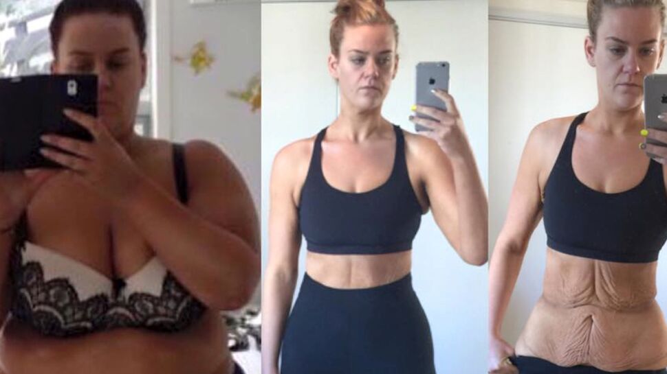 Accusée de mentir sur sa perte de poids, elle dévoile une incroyable photo "avant et après"