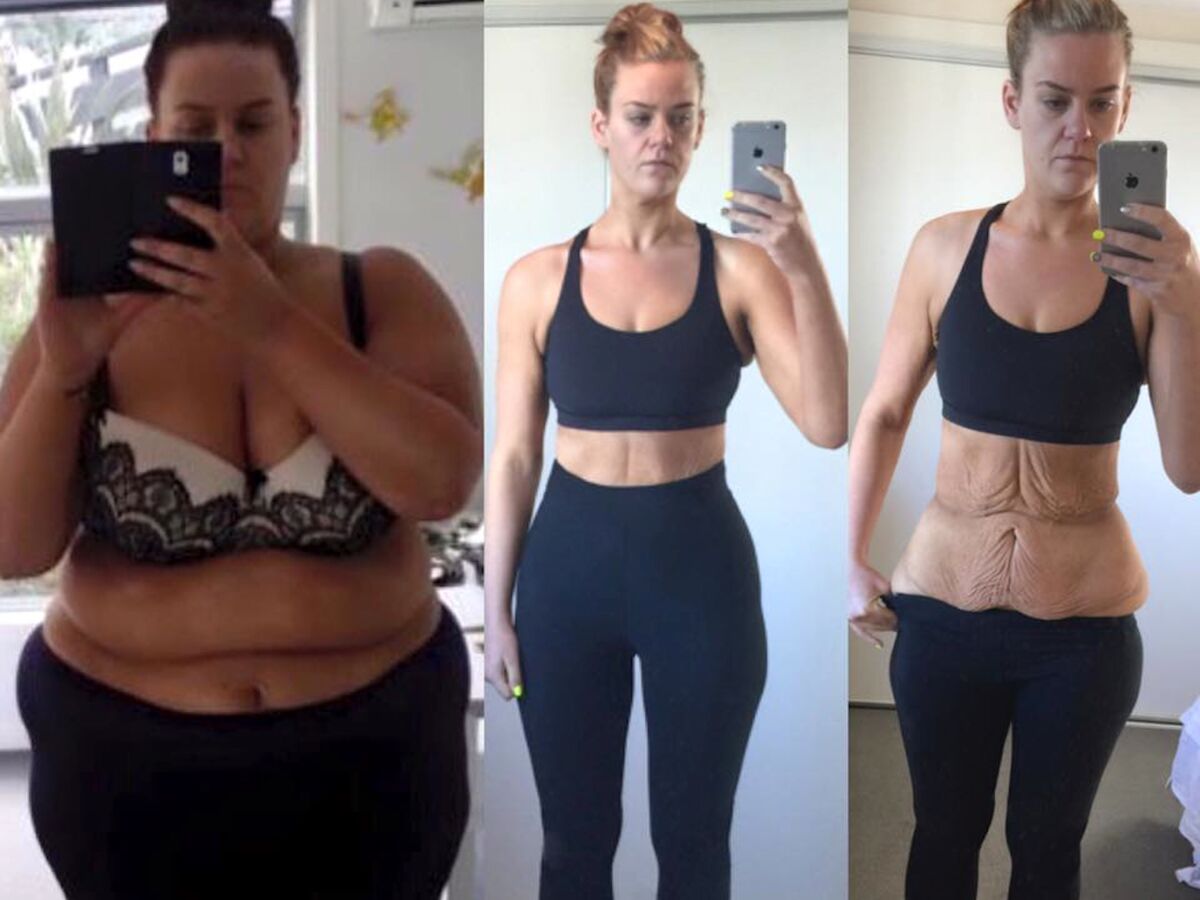 Accusée de mentir sur sa perte de poids, elle dévoile une incroyable photo  avant et après : Femme Actuelle Le MAG