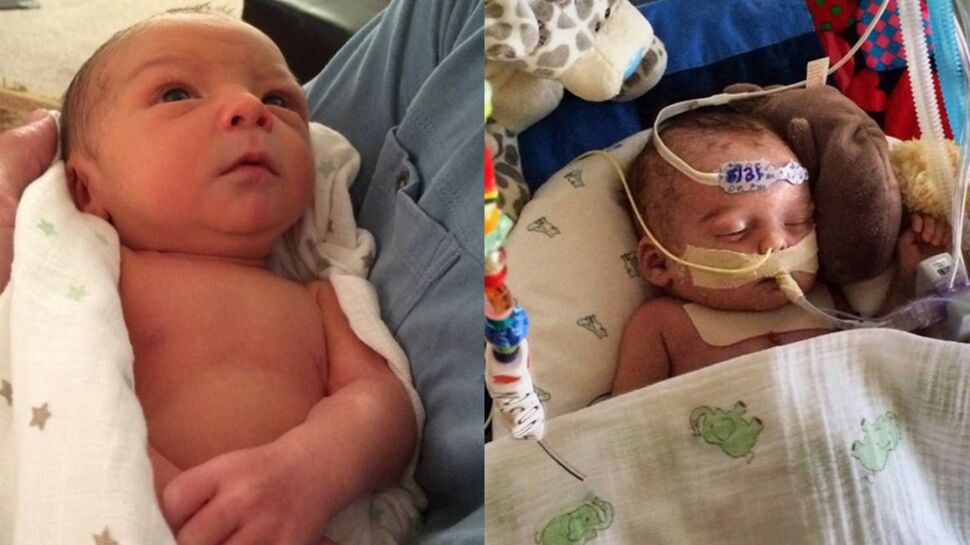 Facebook censure la photo d'un bébé hospitalisé jugée choquante