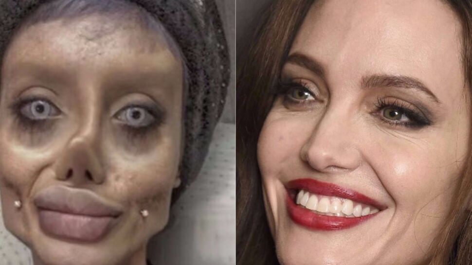 Une jeune fille de 19 ans subit une quarantaine d’opérations pour ressembler à Angelina Jolie