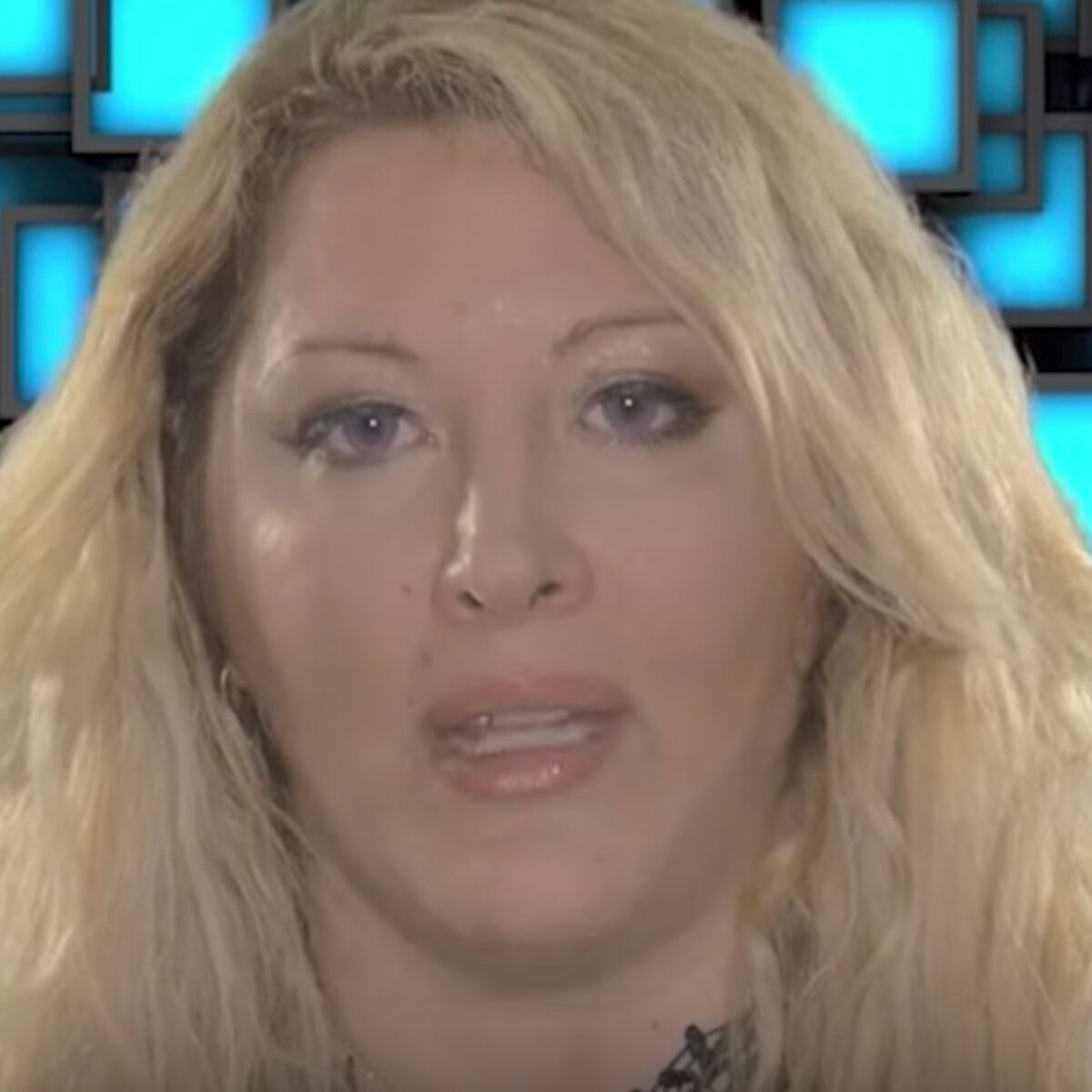 Charlotte 10 Couples Parfait Chirurgie Après sa gastrectomie, Loana fustige les "idiots" qui critiquent la  chirurgie : Femme Actuelle Le MAG