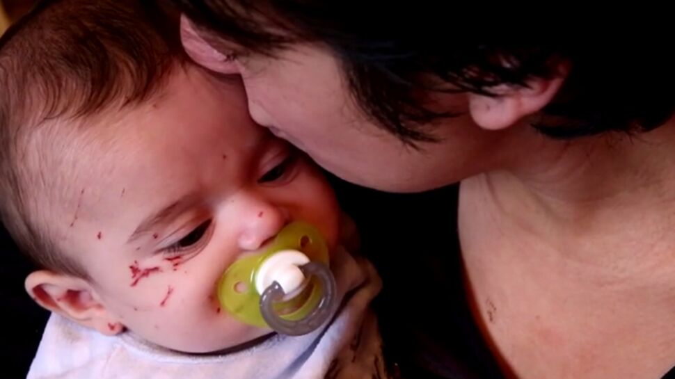 Hospitalisé, un bébé de 4 mois griffé par une fillette de 7 ans