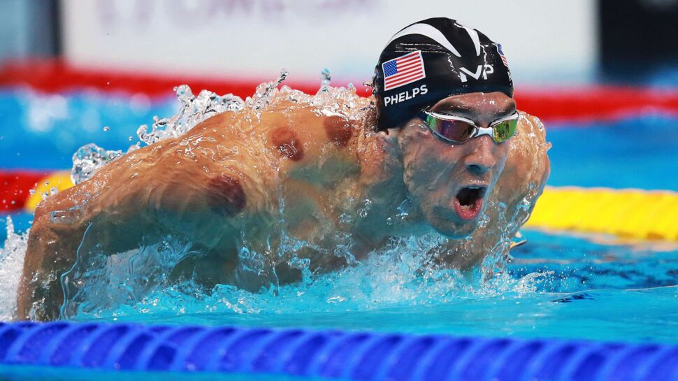 JO 2016 : quelles sont ces marques étranges sur le corps de Michael Phelps ?