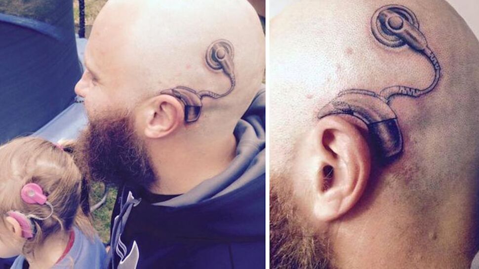 Pour soutenir sa fille atteinte de surdité profonde, il se fait tatouer un implant auditif