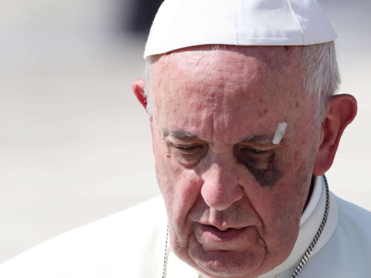 Pourquoi le pape atil un œil au beurre noir ? Femme Actuelle Le MAG