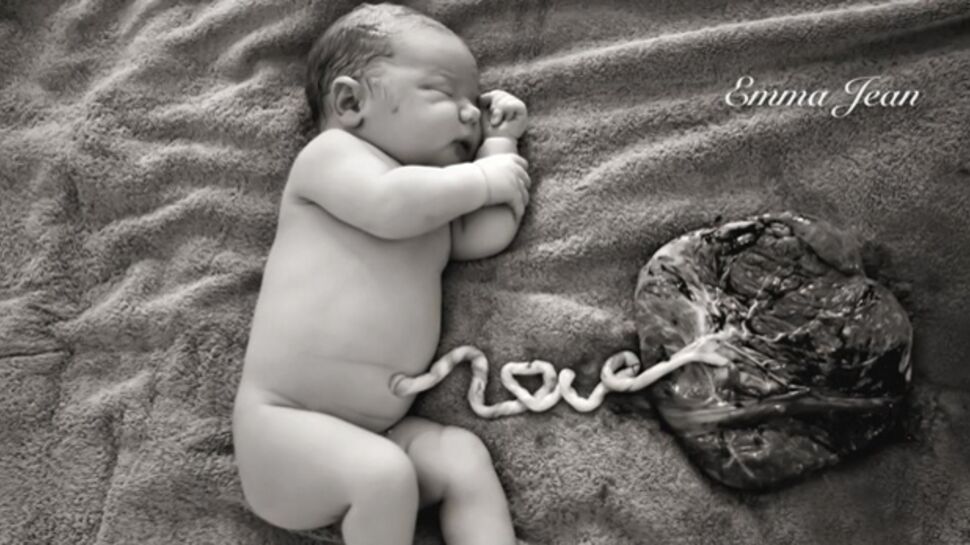 Photo : un nouveau-né relié à son placenta grâce au mot "love"