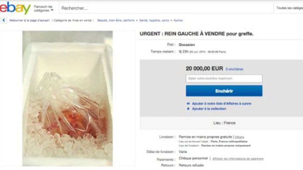 Un rein en vente sur Ebay pour inciter au don d’organes