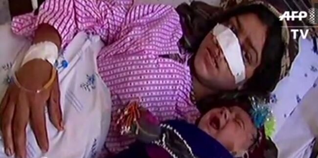 Le comble de l'horreur: un Afghan coupe le nez de sa femme après une dispute conjugale