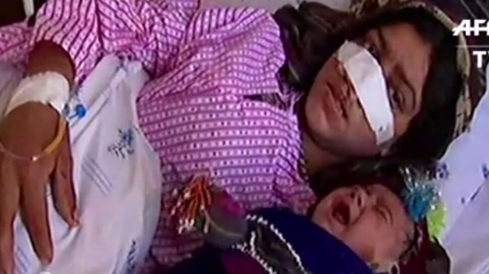 Le comble de l'horreur: un Afghan coupe le nez de sa femme après une dispute conjugale