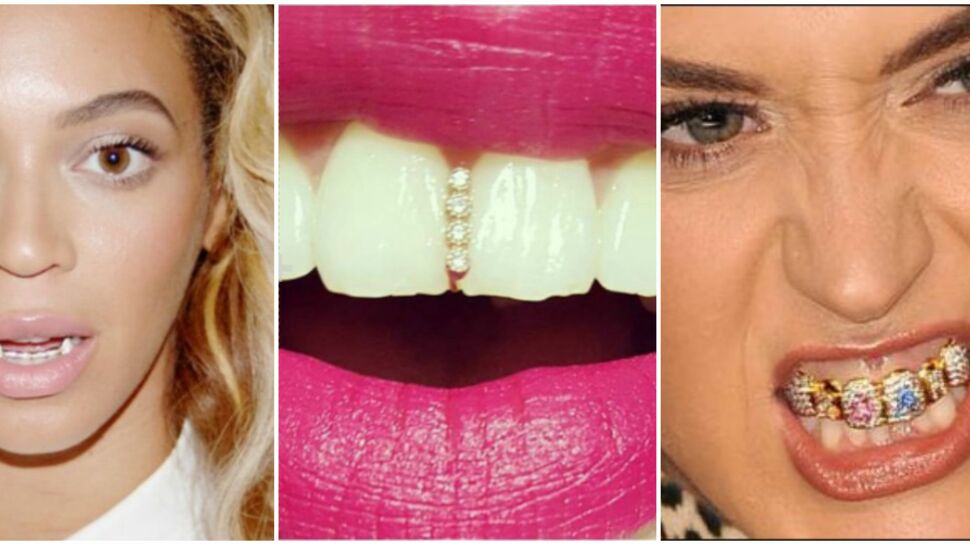 Bijoux de dents : la tendance pas si glamour