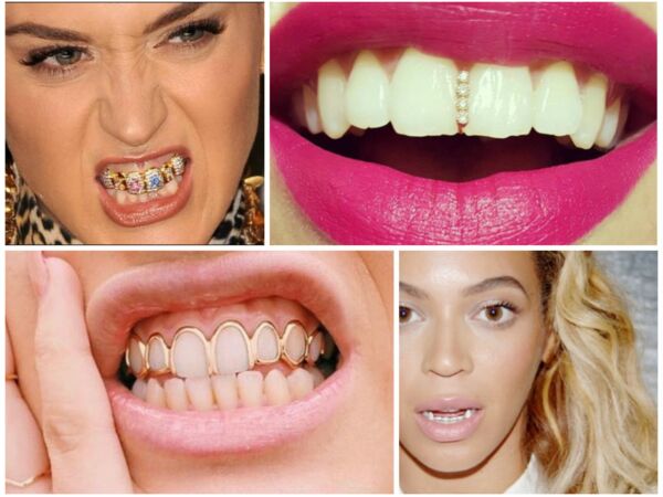 Bijoux de dents la tendance pas si glamour