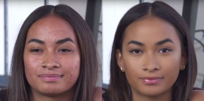Vidéo : un tuto pour camoufler l’acné en 5 minutes