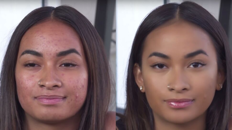 Vidéo : un tuto pour camoufler l’acné en 5 minutes