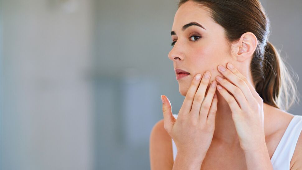 8 choses que vous ne saviez pas sur l’acné adulte