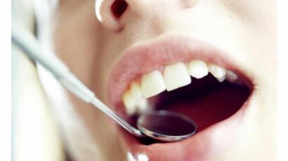 Le charbon végétal pour blanchir les dents : info ou intox ?