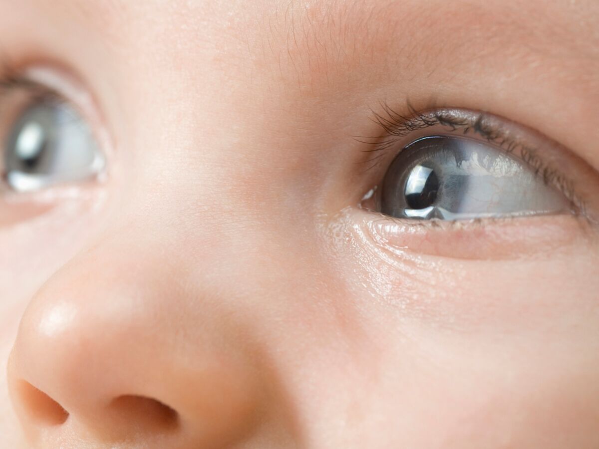 Bébé a toujours les yeux qui pleurent : que faire ? : Femme