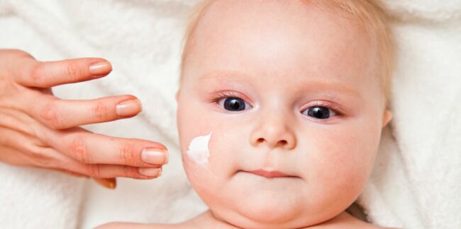 Bien soigner l'eczéma du bébé pourrait le protéger contre l'allergie alimentaire