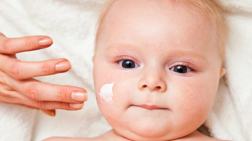 Bien soigner l'eczéma du bébé pourrait le protéger contre l'allergie alimentaire
