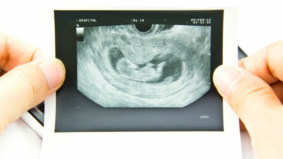 L'évolution du fœtus au premier trimestre de grossesse