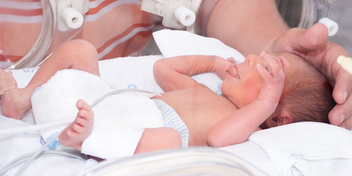 Obesite Et Diabete Les Bebes Prematures Seraient Plus Exposes Femme Actuelle Le Mag