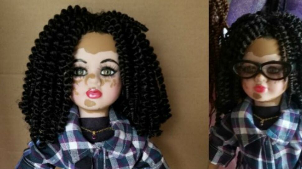 Ces poupées atteintes de vitiligo vont aider les enfants touchés par cette maladie
