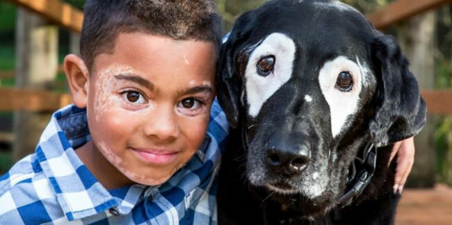 Grâce à ce chien, un petit garçon atteint de vitiligo a retrouvé confiance en lui