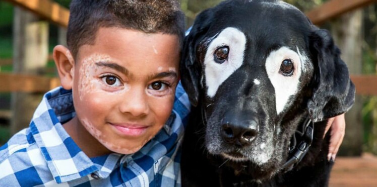 Grâce à ce chien, un petit garçon atteint de vitiligo a retrouvé confiance en lui