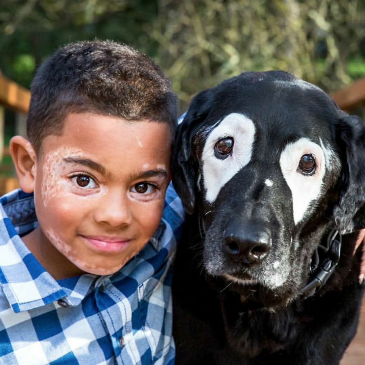 Grâce à ce chien, un petit garçon atteint de vitiligo a retrouvé ...