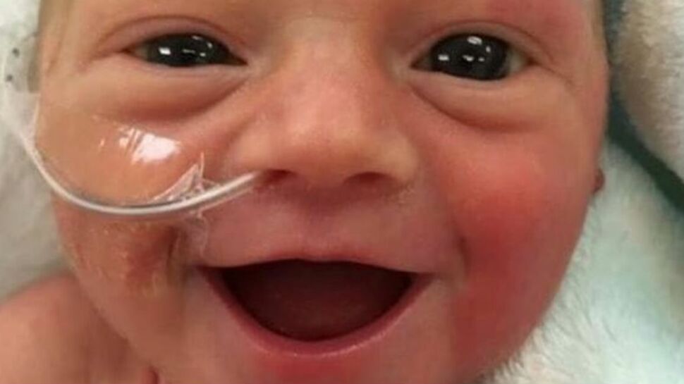 PHOTO - Pourquoi le sourire de ce bébé émeut la toile