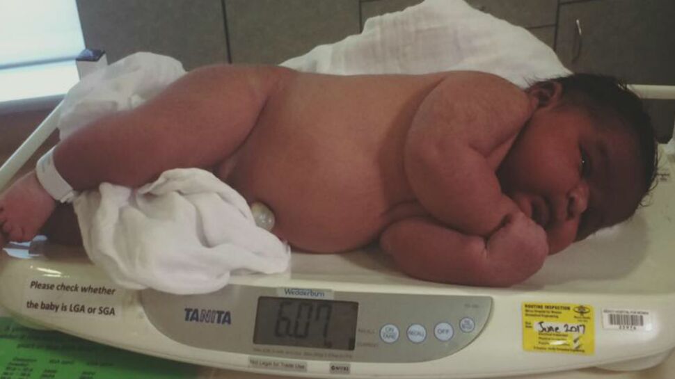 Australie : elle donne naissance à un bébé de plus de 6 kilos sans péridurale