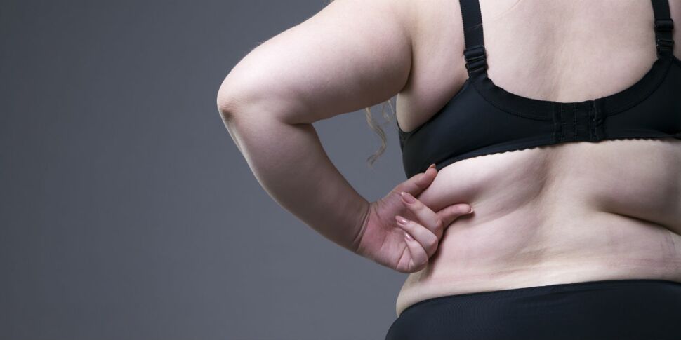 Chirurgie de l’obésité : tout savoir sur la sleeve gastrectomie