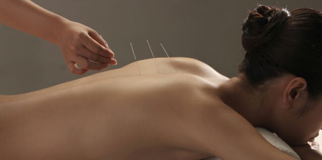 On a testé l'acupuncture pour mincir