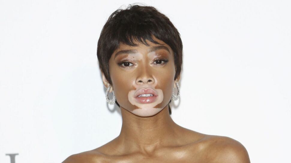 Découvrez le corps surprenant de la mannequin Winnie Harlow, atteinte de vitiligo, qui se dénude sur Instagram